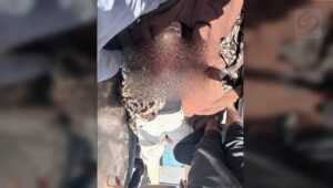 Kekejaman Rezim Israel_